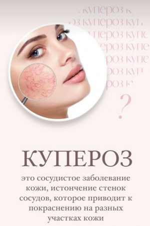 Антикупероз. Процедура для чувствительной кожи