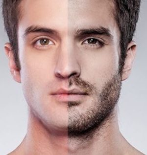 Зона бороды