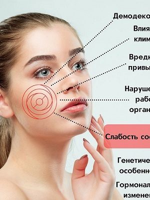 Элос удаление купероза